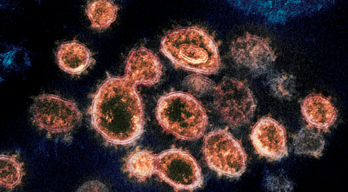 electron microscope image shows SARS-CoV-2 virus