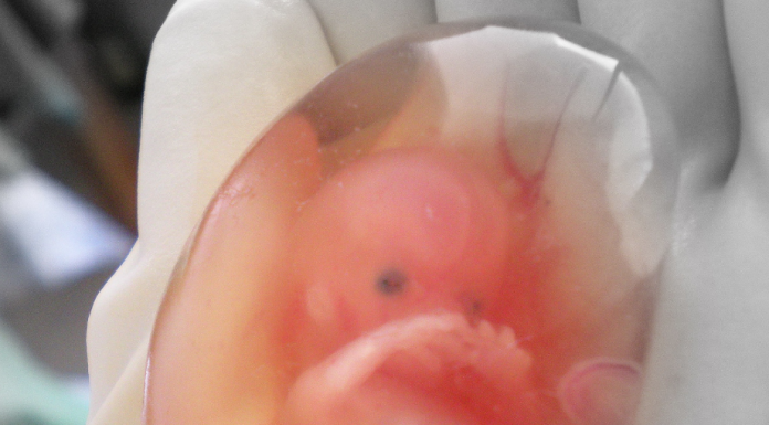 Fetus, 10 weeks