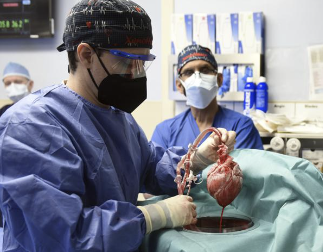 Members of the surgical team show the pig heart for transplant into patient David Bennett