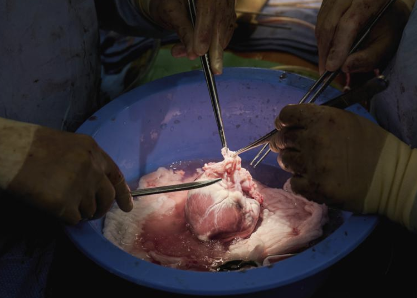 Surgeons prepare a genetically modified pig heart for transplant