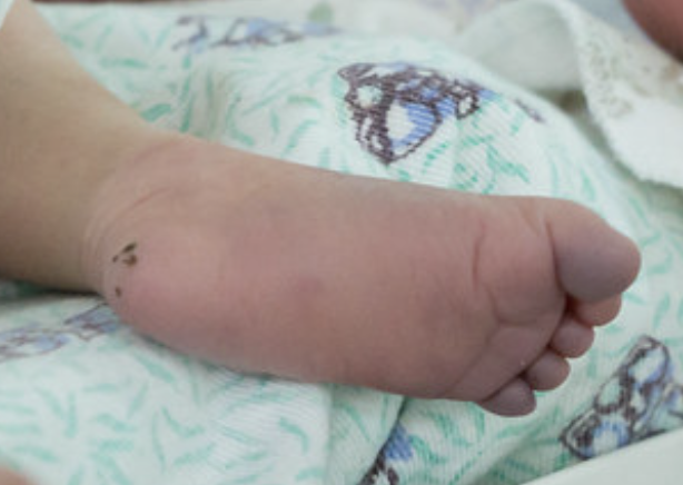 File photo: Foot of newborn