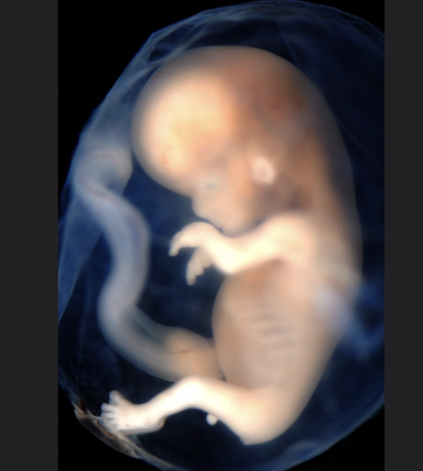 Living human fetus