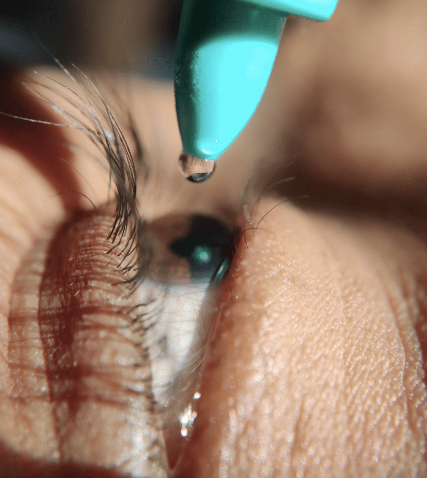 Eye drop taking on eye -