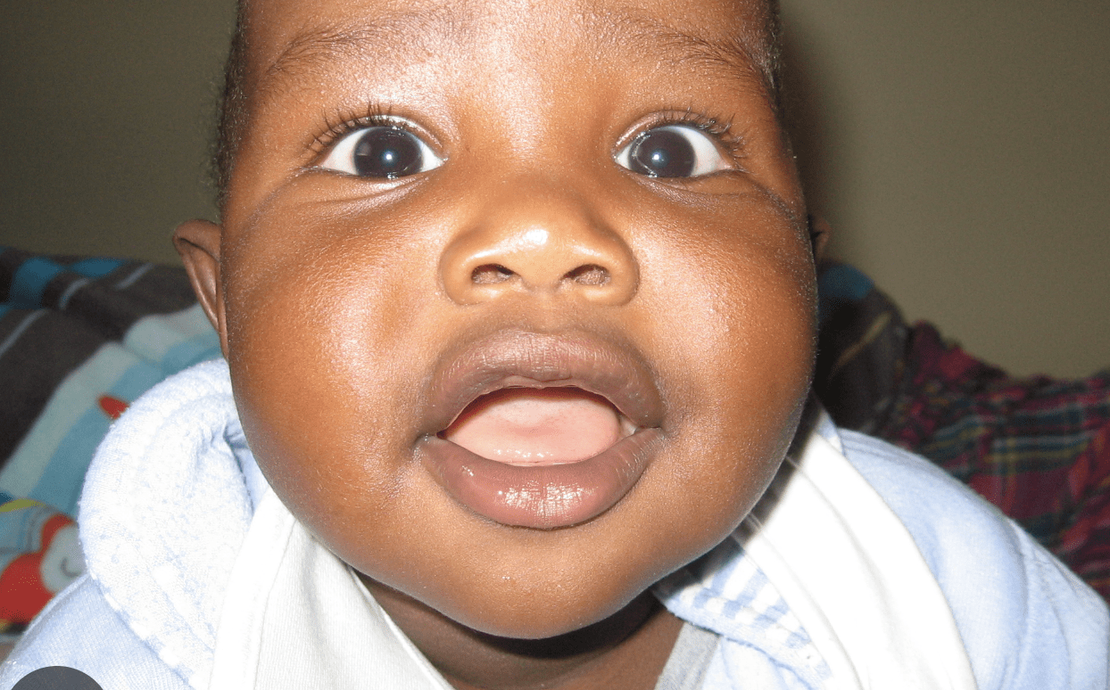 FILE PHOTO: File:Black African Baby At 24 Months - Wikimedia Commons