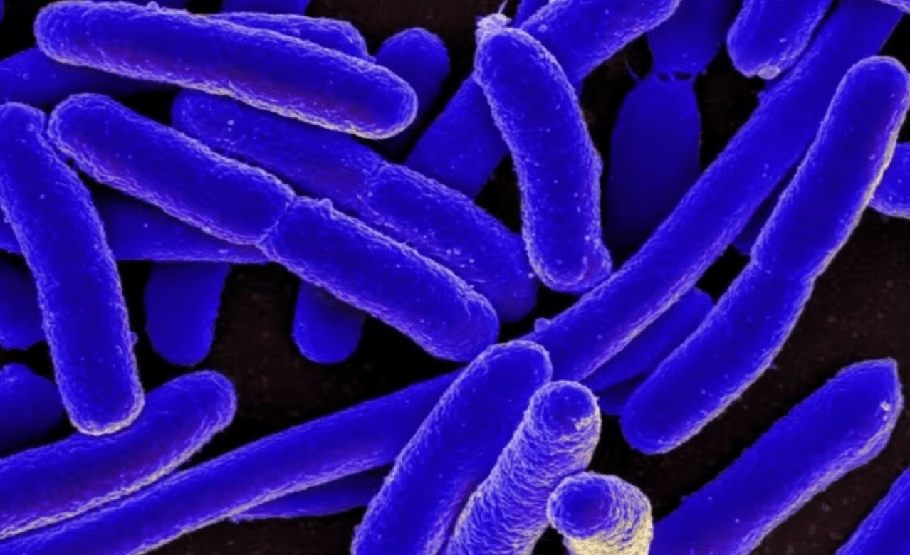 A colorized scanning electron micrograph of Escherichia coli, or E. coli, grown in culture and adhered to a cover slip. Certain strains of E. coli are capable of causing severe disease. That's the situation right now in Alberta, where an outbreak linked to a shared kitchen in Calgary has sickened hundreds of daycare-aged children.